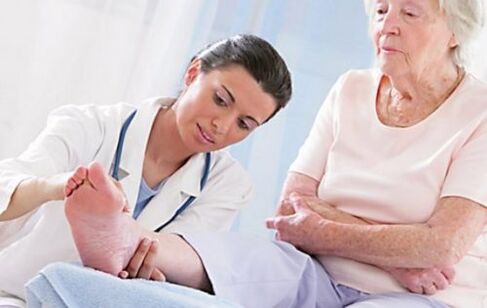 Obiščite zdravnika, če imate simptome krčnih žil